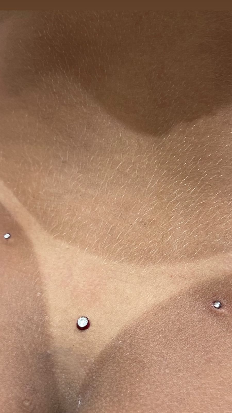 Aplicações de piercing dermal no colo