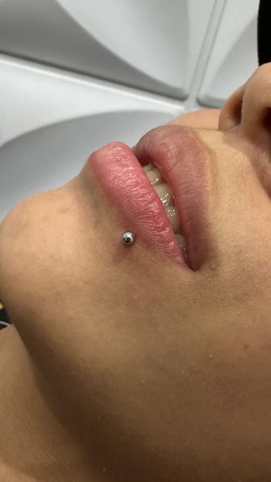 Piercing labret aplicado no lábio